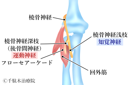 後骨間神経麻痺 こうこつかんしんけいまひ 文京区の接骨 鍼灸 整体の総合治療院 千駄木治療院