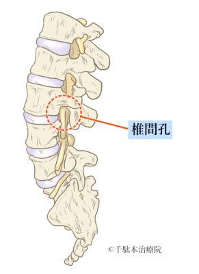 椎間孔＿手の痛み・しびれ