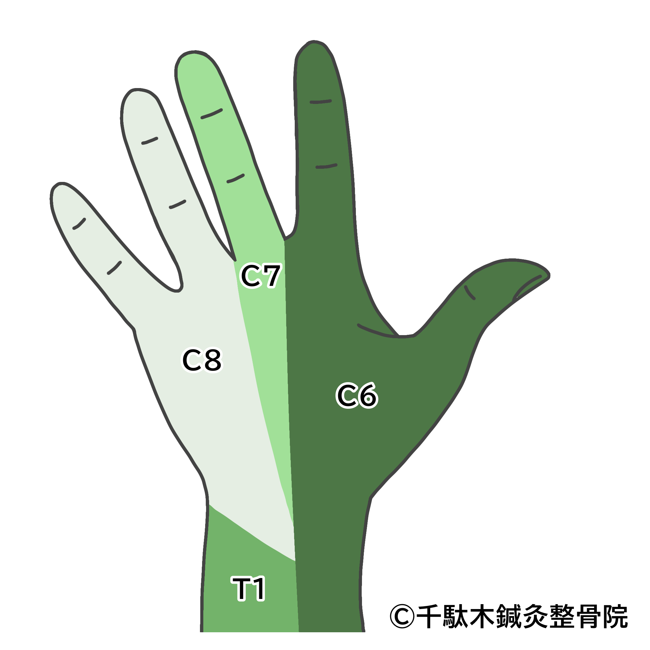 橈骨神経麻痺 とうこつしんけいまひ Radical Nerve Palsy 文京区の接骨 鍼灸 整体の総合治療院 千駄木鍼灸整骨院